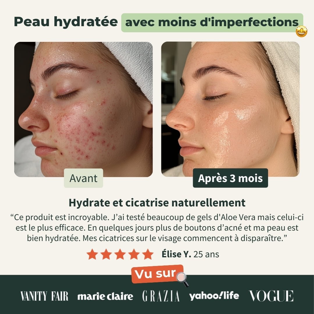Gel Aloe Vera Bio 100% Pur et Natif - Visage, Corps, Cheveux