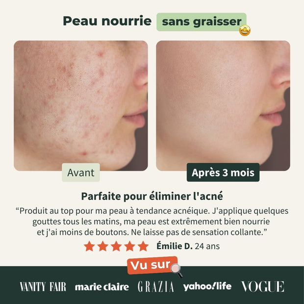 Huile de Jojoba Bio