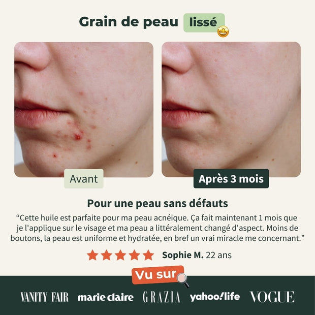 Huile de Nigelle Bio